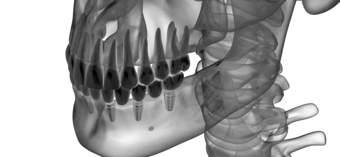 2. odontiatriko_athinon_emfitevmata_2